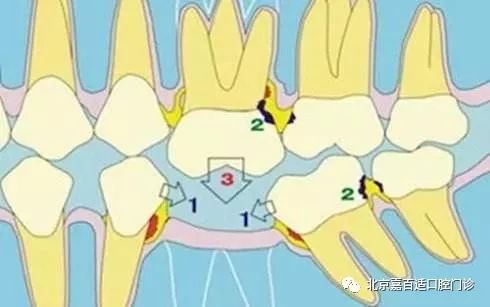 牙齿正畸有这么多好处 你竟然都不知道……-3.jpg