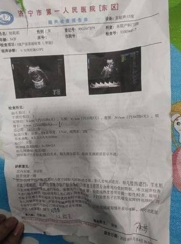 事发济宁第一人民医院！延误治疗13个小时？胎儿不幸夭折-2.jpg