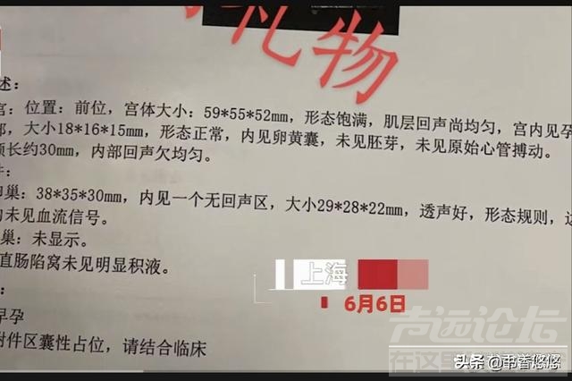 上海女子意外怀孕想打胎遇疫情，隔离73天胎儿4个月，网友：天赐-1.jpg