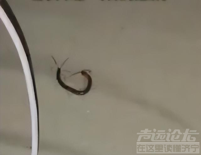 女子睡觉被10厘米蜈蚣咬太阳穴：被疼醒了脸都是肿的，4天内被2条蜈蚣咬了3个伤口-2.jpg