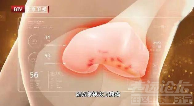 走路是“天然良药”，控三高、强肺脏！但什么时候走，走多久……有讲究！-4.jpg