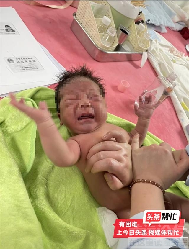 河南婴儿在医院洗澡做“排气操”后进ICU？父亲称已2次手术生命垂危，卫健委介入-4.jpg