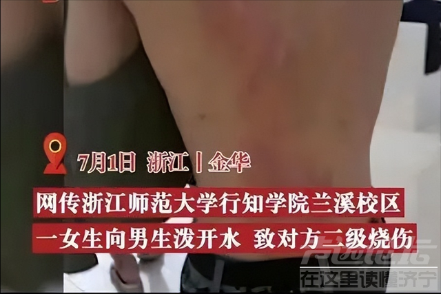 高校女生冲男同学泼开水致二度烧伤，放话大不了装抑郁，后续来了-1.jpg