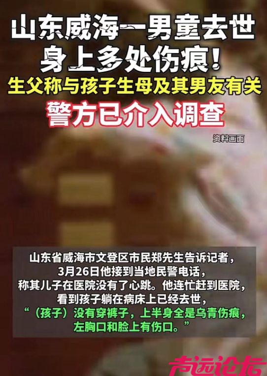 5岁男童被母亲活活打死，父亲晒受伤照，脸上全都是淤青，太残忍-1.jpg