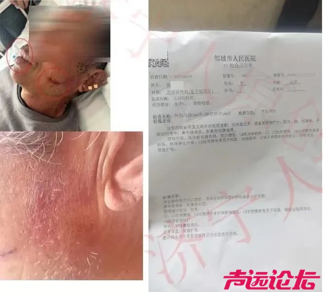 济宁一村支书动手打老人，致轻微伤-2.jpg