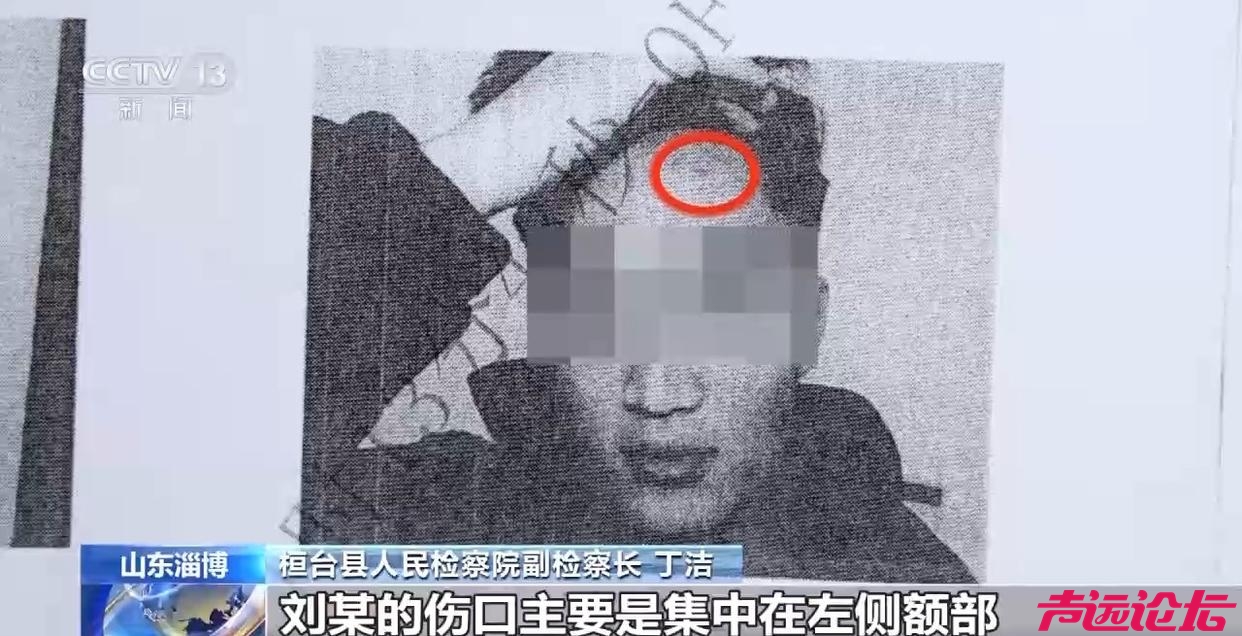 被打后还手属于正当防卫还是互殴？如何认定？来看案例-11.jpg