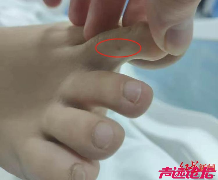 三亚市区都有那么多蛇吗？“27岁女游客疑被蛇咬伤身亡”事件发布通报！-1.jpg