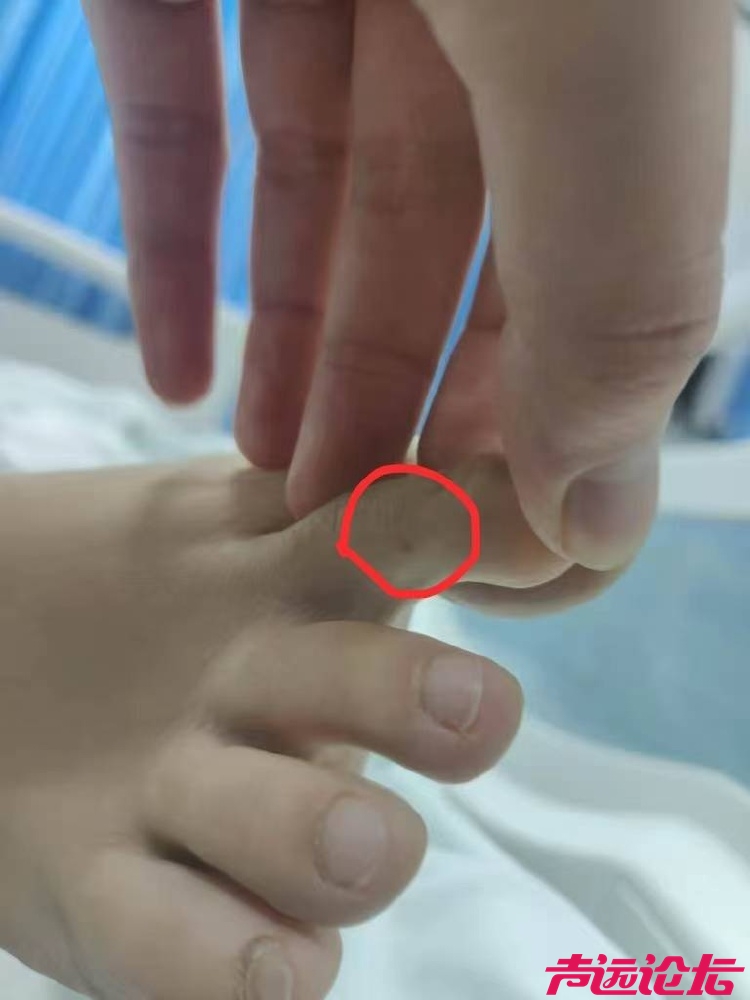 三亚死亡女子家属回应质疑：第二家医院使用了血清抢救，愿意尸检-2.jpg