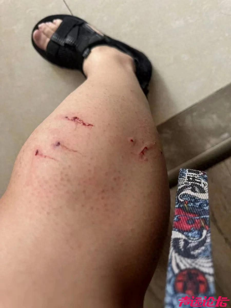 沪上一女子腿上被咬出4个血洞！小区内成群结队、危机四伏，不少人中招-1.jpg