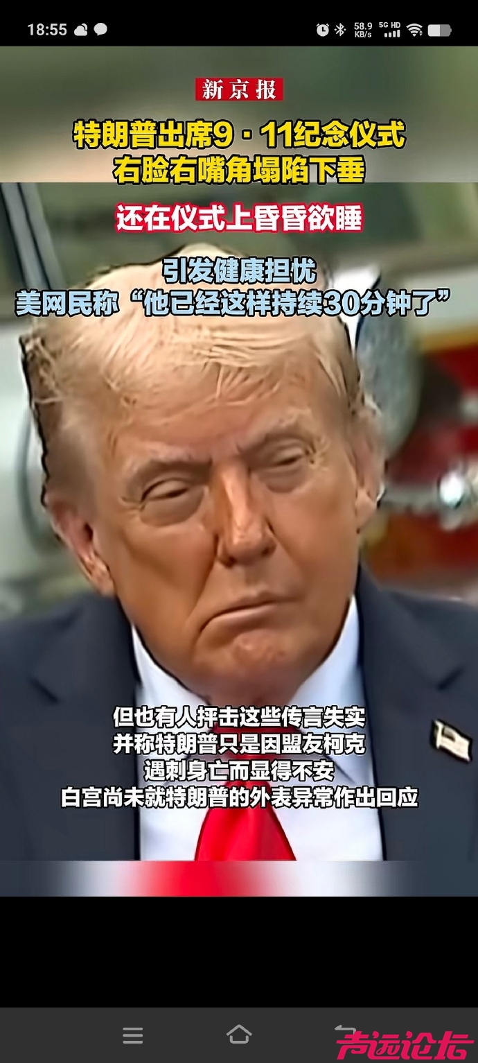 006v119zgy1i5b3xt5p7rj30z025skac.jpg
