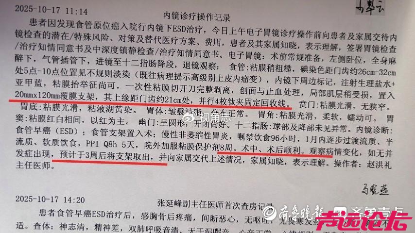 术后食道穿孔，梁山一女士胸腔、纵隔被感染-2.jpg