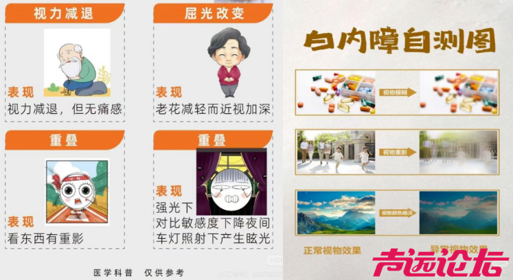 清晰看世界 光明伴您行--济宁市第一人民医院白内障门诊守护您-1.jpg