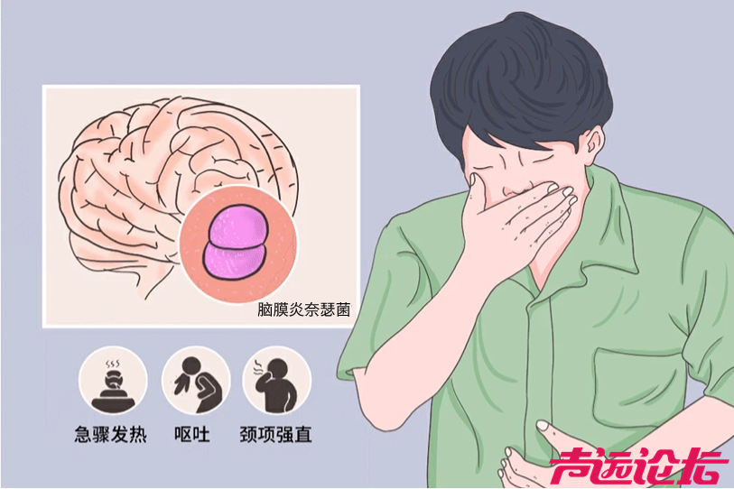 传染性强、后遗症严重！正值流脑高发季，中疾控提醒-1.jpg