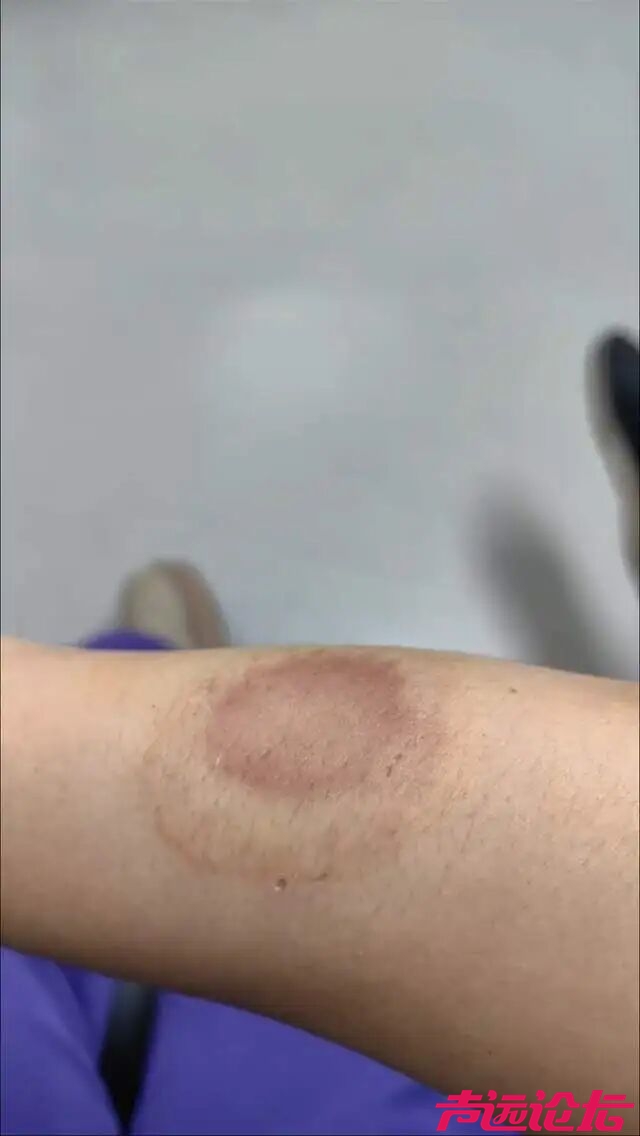 贴条提醒邻居“别在我门口放垃圾”，对方谎称“捉奸”，凌晨撬锁入室对女子进行殴打！-3.jpg