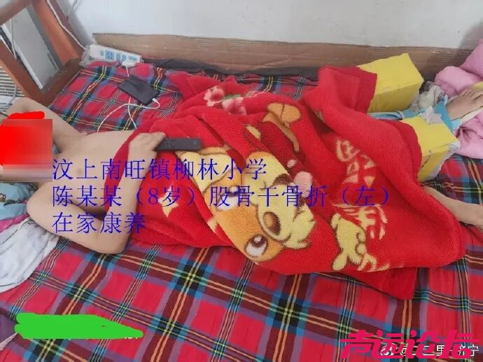 济宁小学老师脚踢8岁学生致骨折-3.jpg